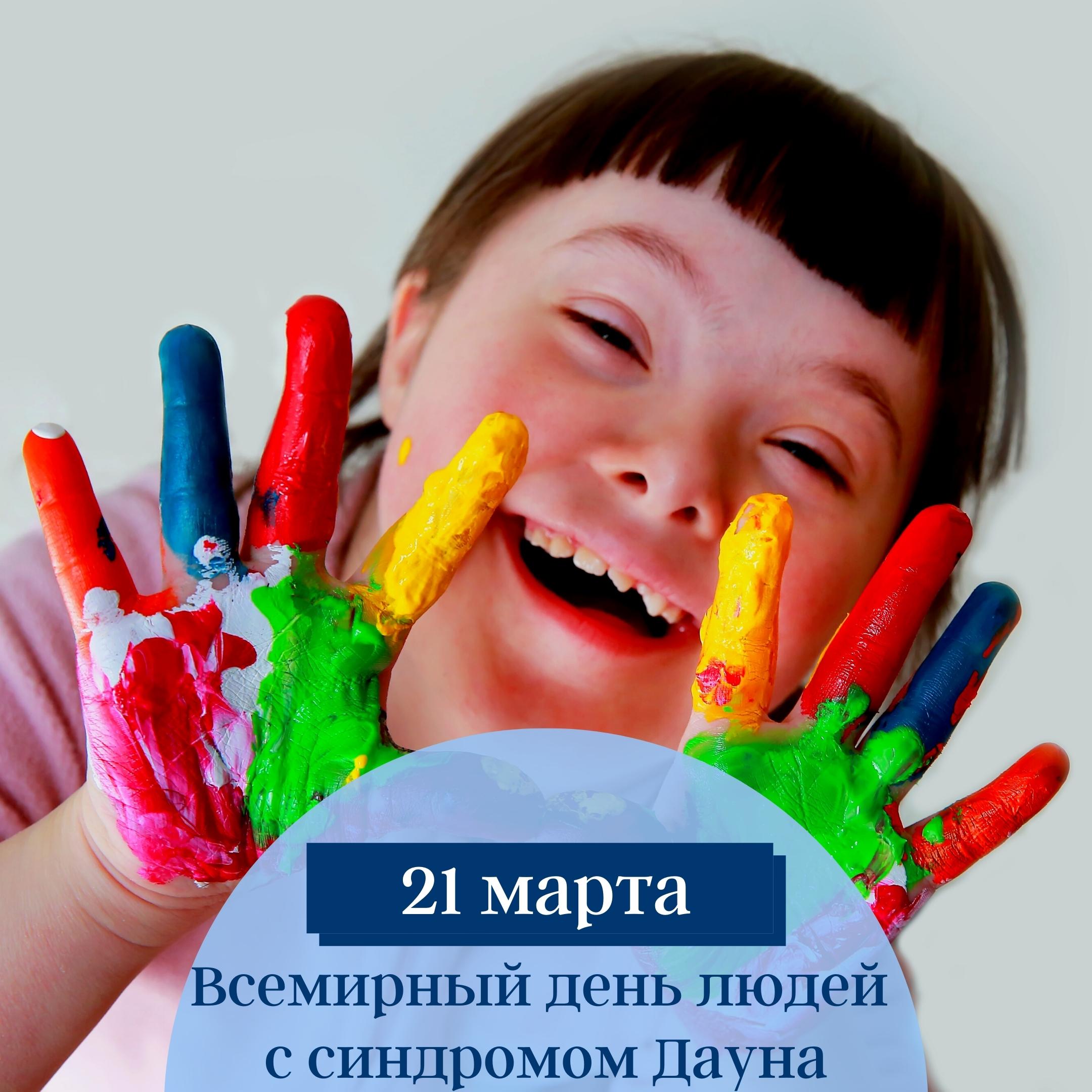 День дауна в детском саду. Всемирный день даунов. Синдром Дауна 21 хромосома.
