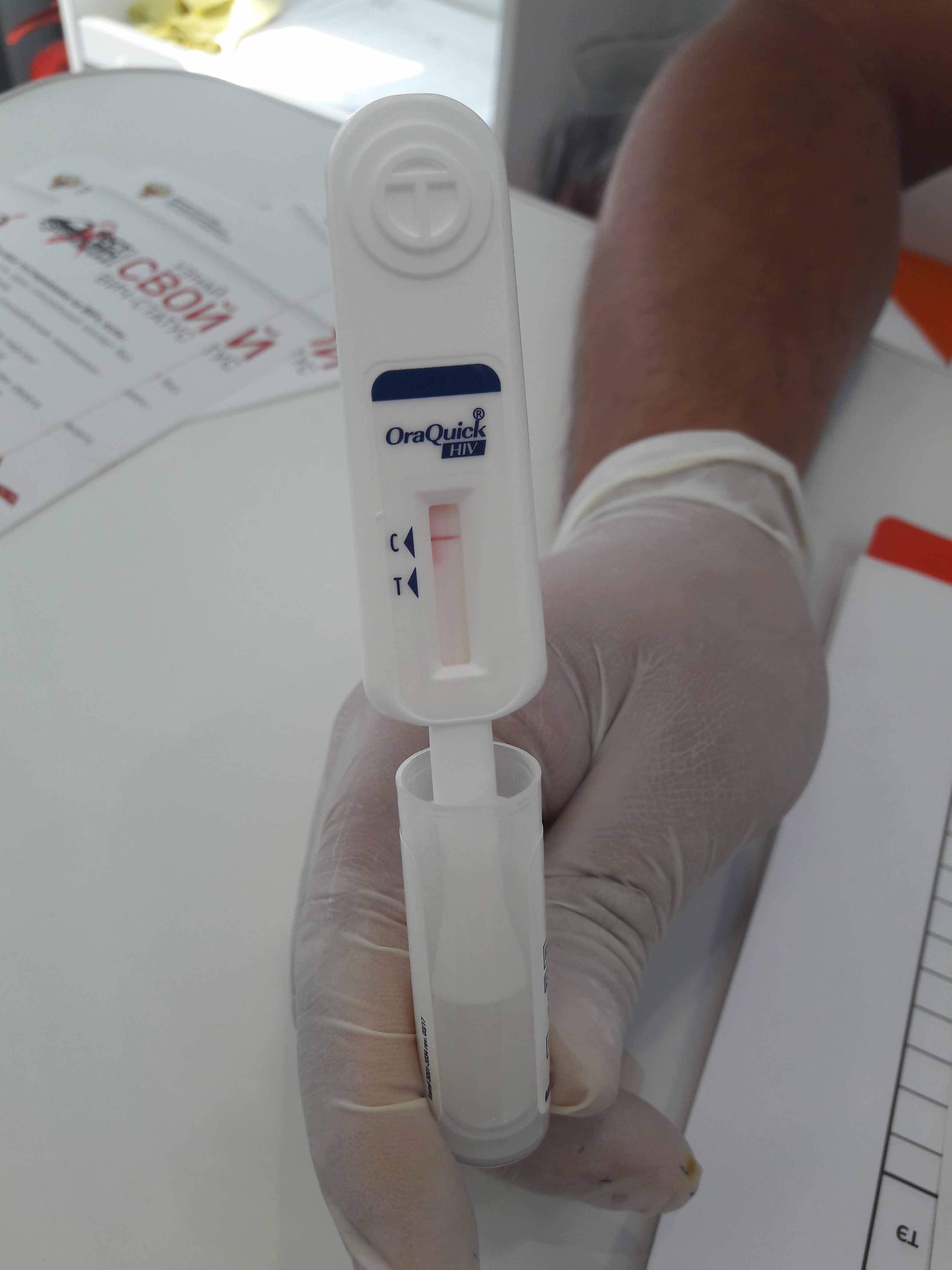 Тест на вич достоверный. Тест на ВИЧ. Экспресс тест на ВИЧ. Тест на ВИЧ И СПИД. Тест на ВИЧ на Десну.